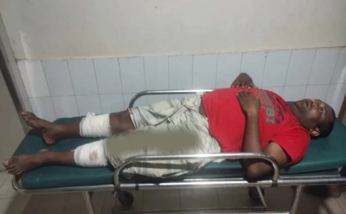 রিকশাচালকের পা ভাঙলো ট্রাফিক পুলিশ 