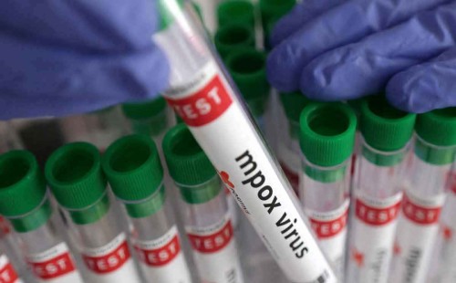 এমপক্সের প্রথম টিকার অনুমোদন 