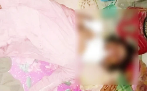 গরম পানিতে ঝলসে দিল কিশোরীর শরীর 