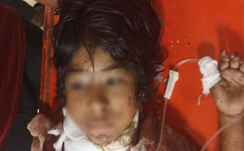 সীতাকুণ্ডে গলা কাটা সেই শিশুটি মারা গেছে 